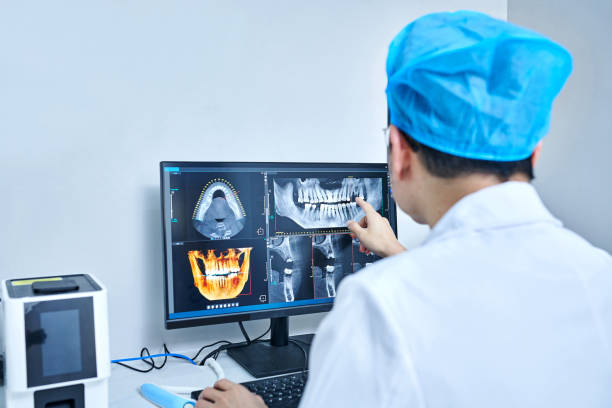 Best Emergency Tooth Extraction in Interlaken, CA